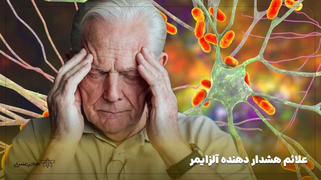 علائم هشدار دهنده آلزایمر
