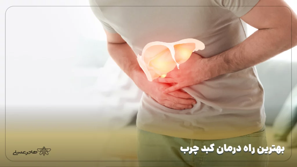 بهترین راه درمان کبد چرب