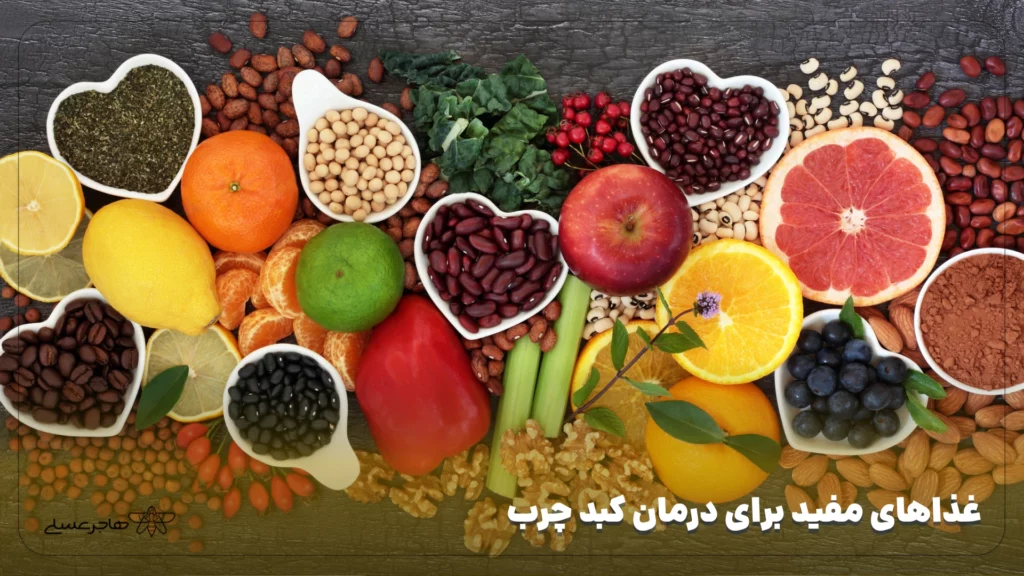 غذاهای مفید برای درمان کبد چرب